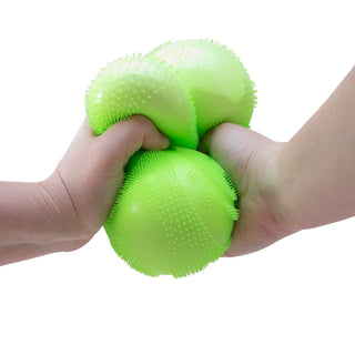 Two hands squeezing a large neon green spiky sensory Needoh stress ball